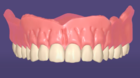 Designing a single arch denture