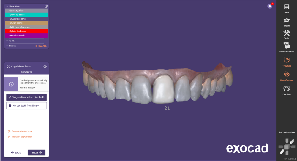 3.1 Pre op workflow 1.png